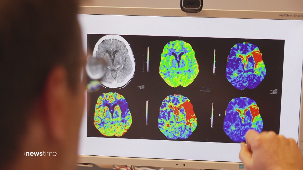 Schlaganfall: Schnelle Hilfe rettet Leben