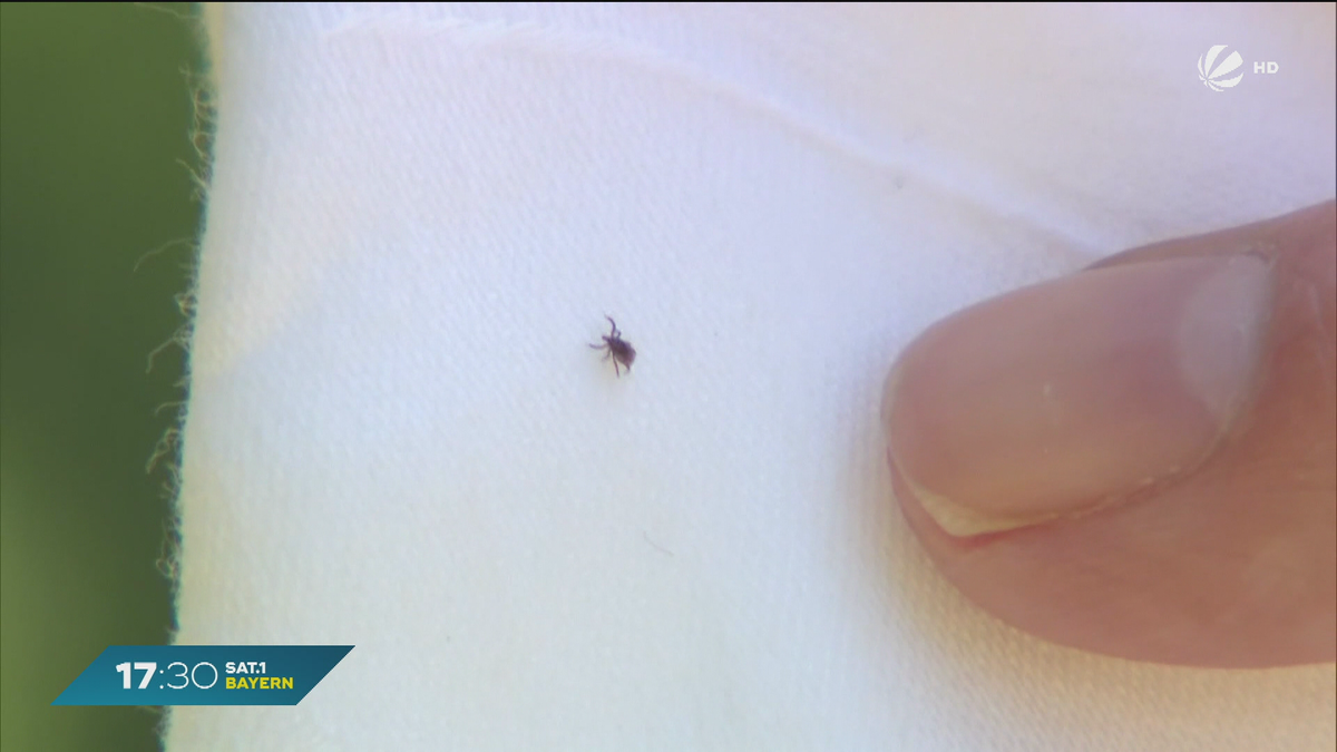 Mehr Borreliose-Fälle in Bayern: Patientin mit schwerem Verlauf