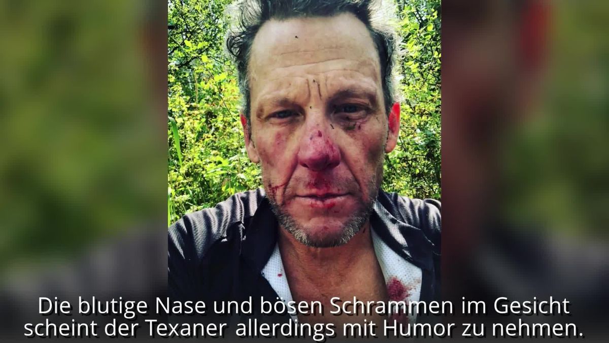 Lance Armstrong: Ex-Radprofi beim Fahrradfahren verunglückt