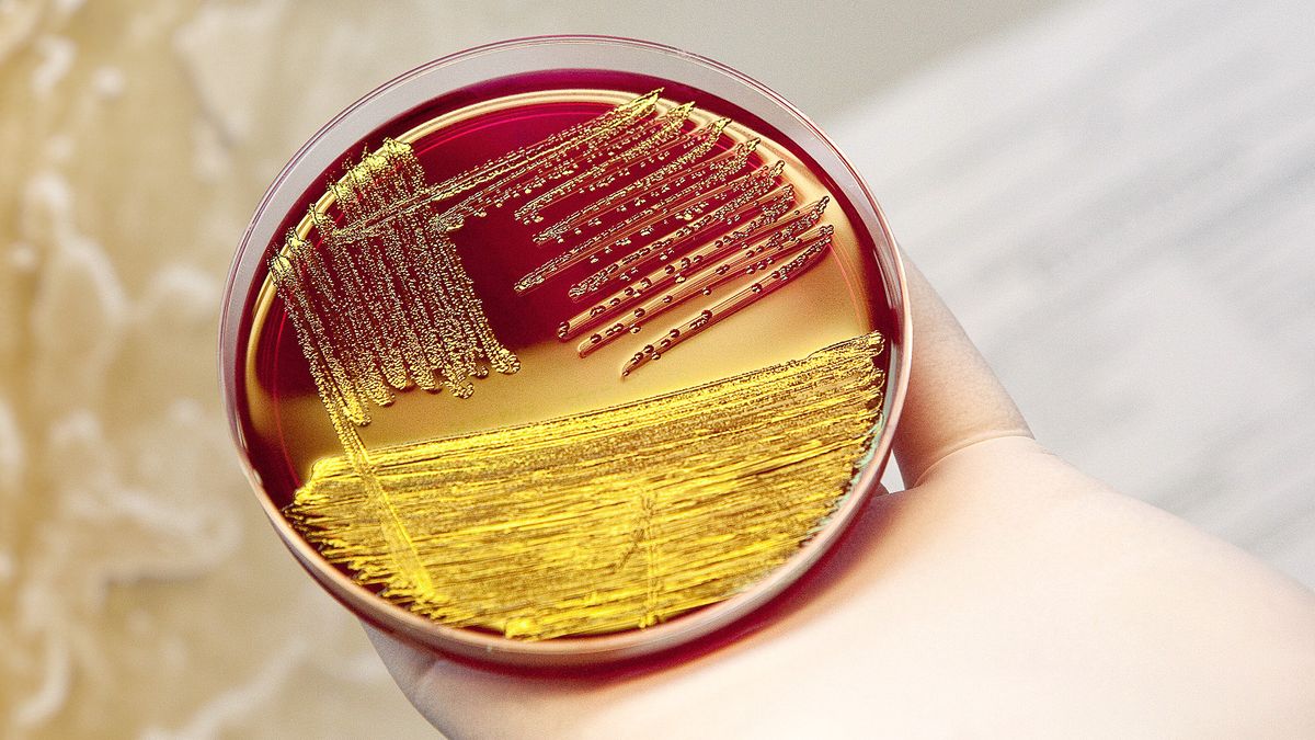 Gefährliches EHEC-Darmvirus ist zurück
