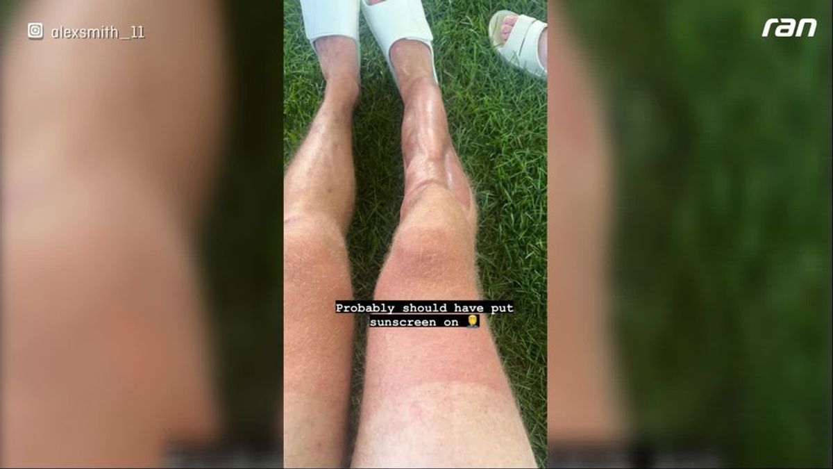 NFL: Ex-QB Alex Smith zeigt Bein - vom Horror gezeichnet