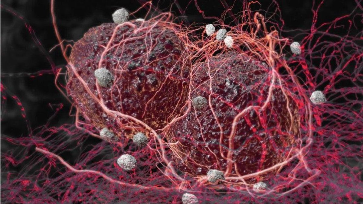 Medizinischer Durchbruch? Forscher bekämpfen Krebs mit Nano-Chips