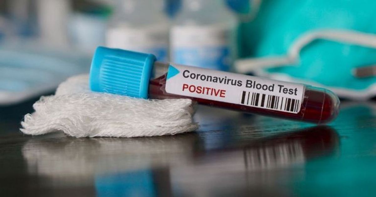 Corona vs. Grippe: Das sind die 5 größten Unterschiede