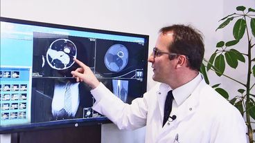 Montag: Riesiger Tumor im Bein entdeckt
