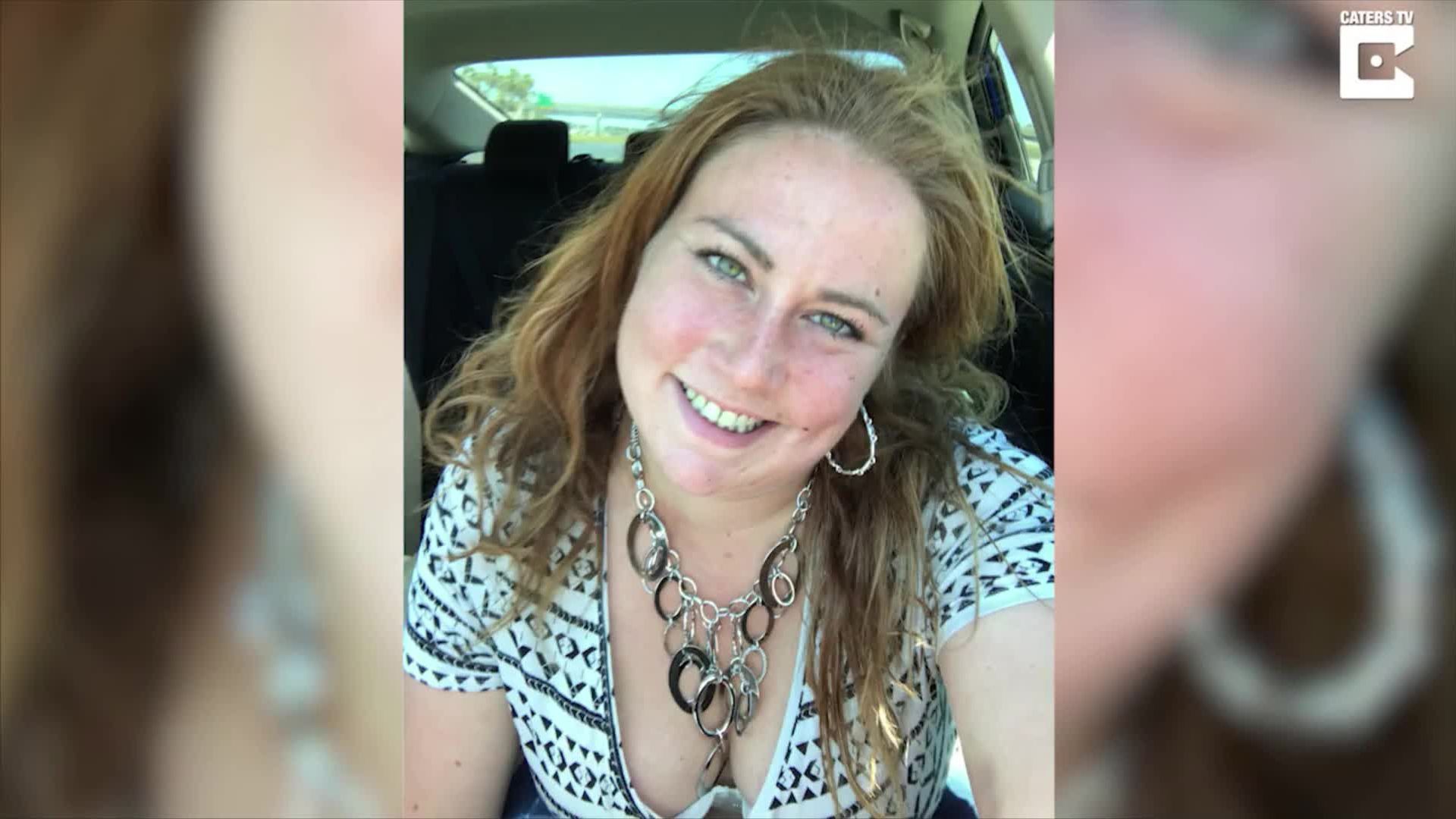 Diese Frau lebt bereits seit 28 Jahren mit einer tödlichen Hautkrankheit -  nun zeigt sie sich und will auf die Erkrankung aufmerksam machen | ProSieben