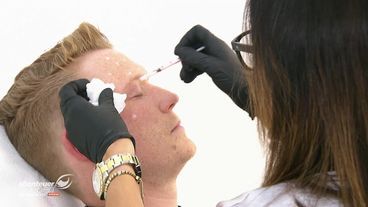 Eine Portion Botox und ein schwerer Schulterbruch