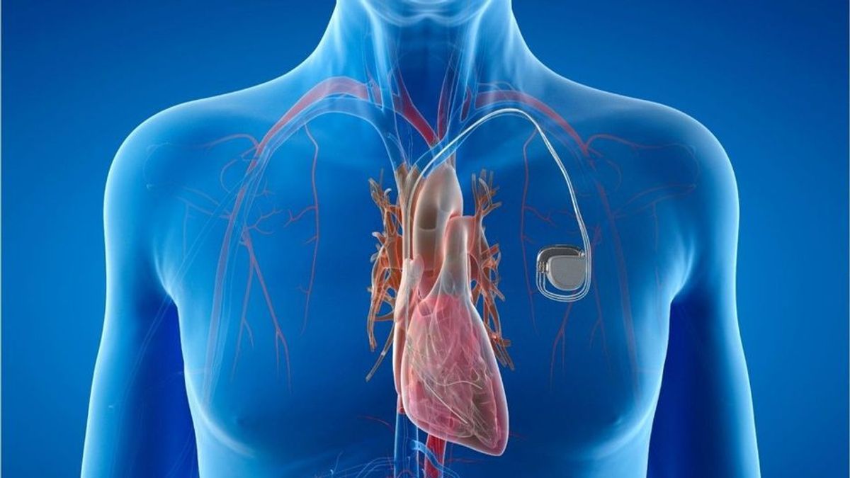 Studie: Smartphones und Co. können Herzschrittmacher anhalten
