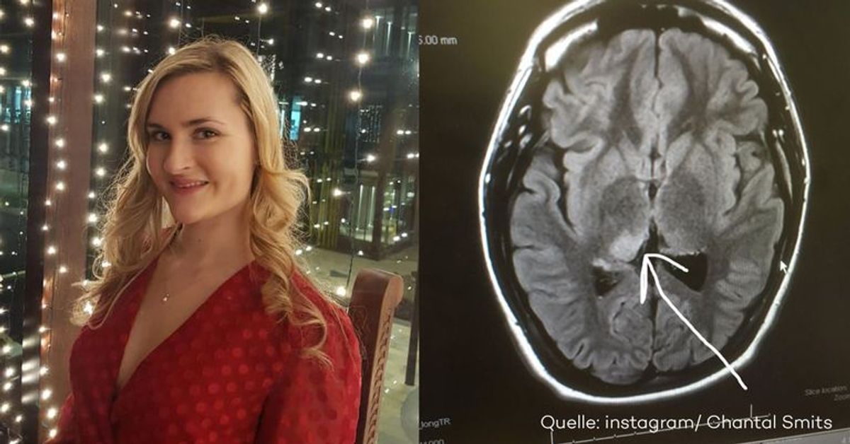 Frau diagnostiziert bei sich selbst einen Hirntumor - mithilfe eines Plakats