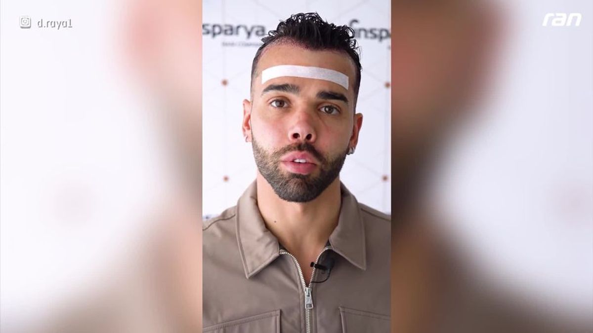 Arsenal-Star mit Haartransplantation: Neue Matte für David Raya