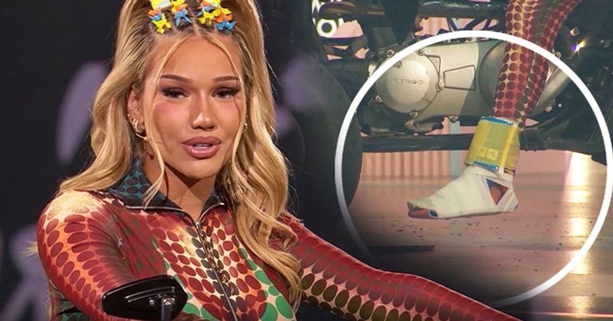 "Wer stiehlt mir die Show?": Shirin David stürzt und bricht sich Knöchel