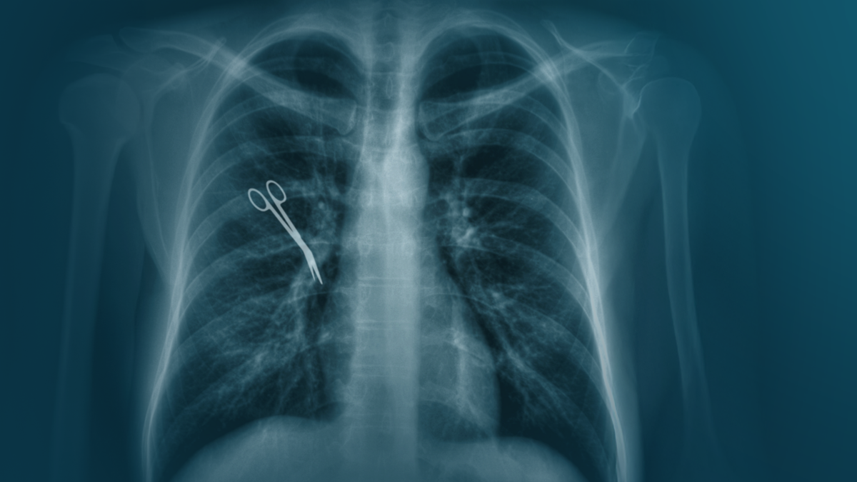 Tausende OP-Behandlungsfehler pro Jahr