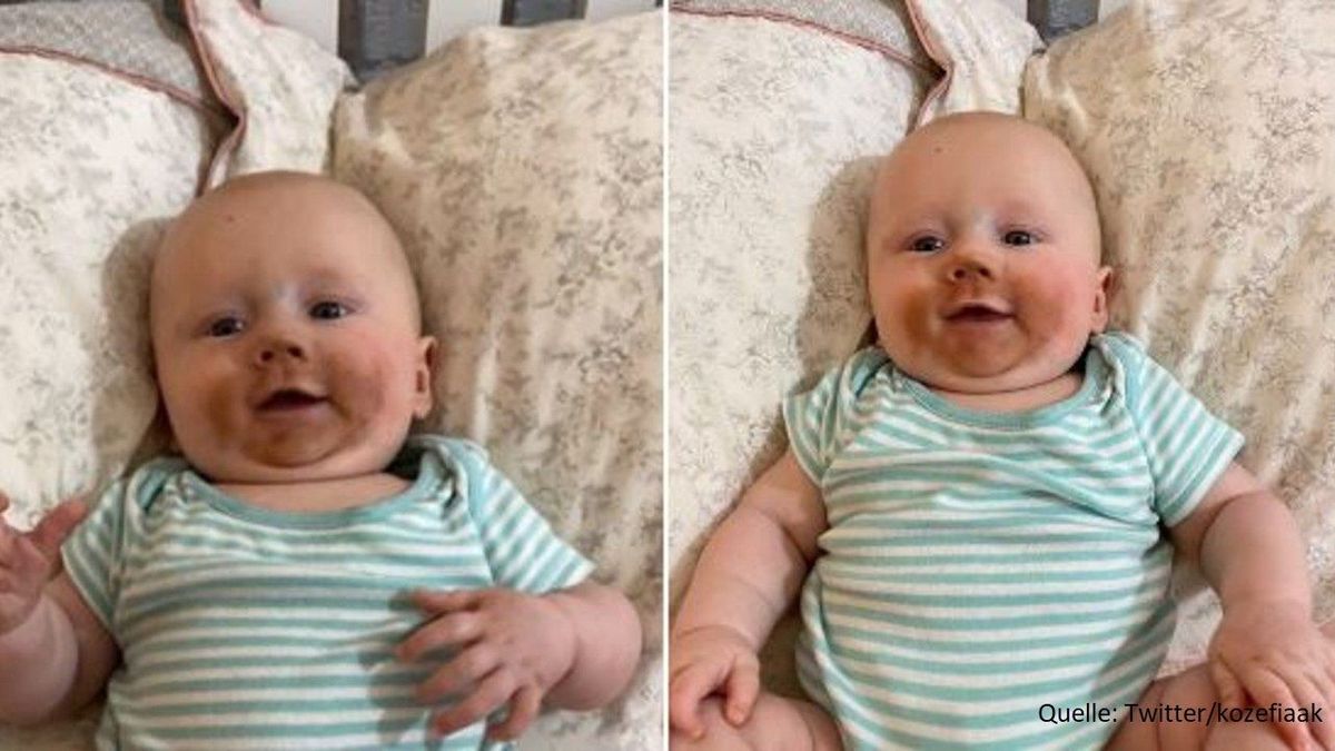 Selbstbräuner-Fail beim Stillen: Baby mit brauner Schnute amüsiert Twitter