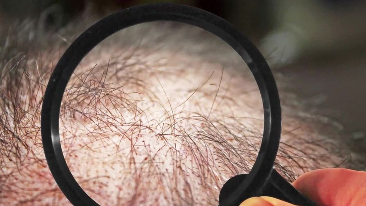 Haben Wissenschaftler eine Heilung für Haarausfall gefunden?