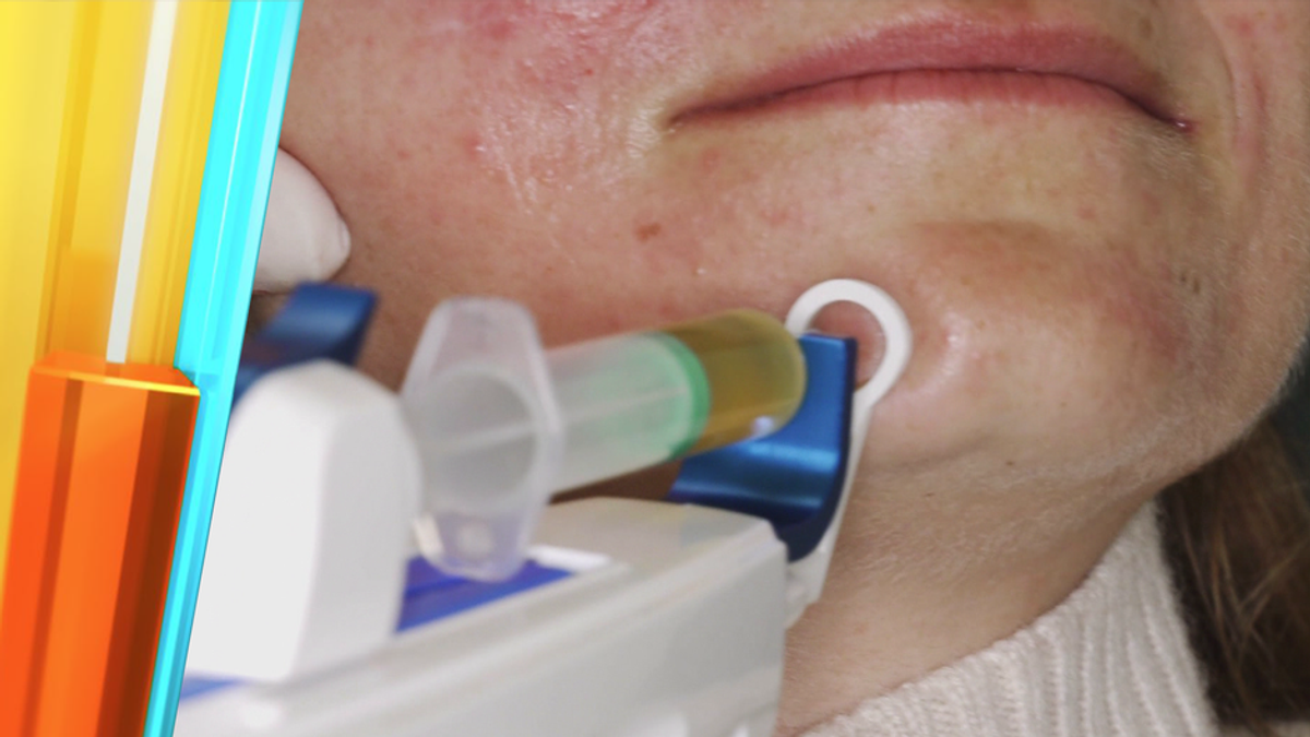 Stammzellen statt Botox? Der neue Beauty-Trend im Check
