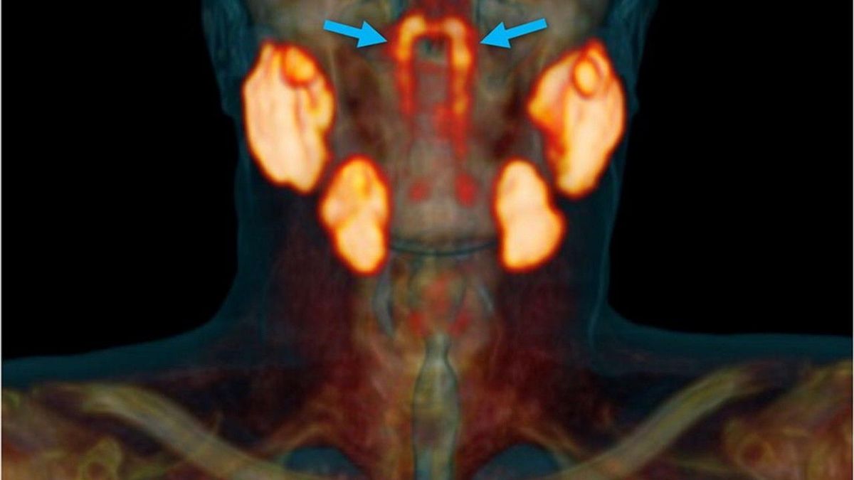 Wissenschaftler haben ein neues Organ im Kopf entdeckt