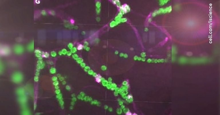 Beeindruckende Entdeckung: Diese Mikroalgen können Gehirn mit Sauerstoff versorgen