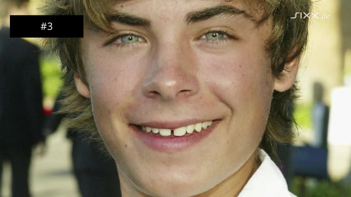 Zac Efrons Fotofails