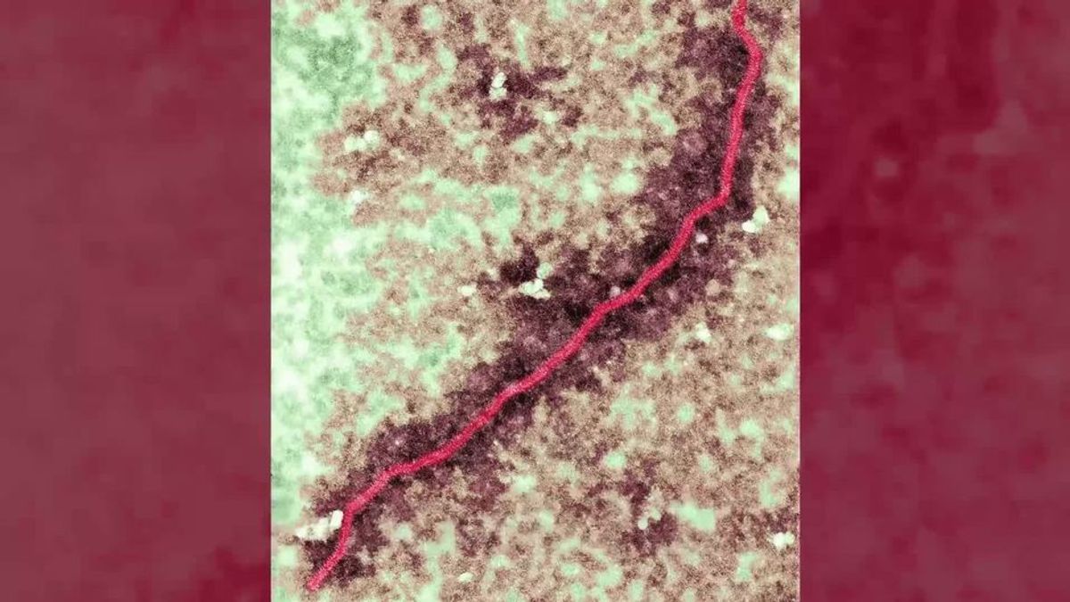 Droht jetzt eine Pandemie? Der unheilbare Nipah-Virus bricht in Indien aus - und er ist in 75% aller Fälle tödlich